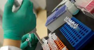 Ankara Üniversitesi açıkladı: SARS-COV-2 virüsü izole edildiğini açıkladı!