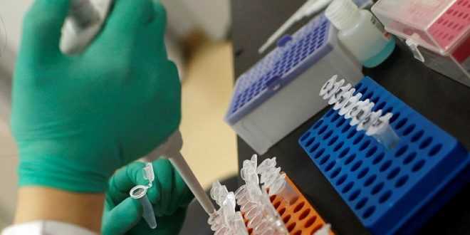Ankara Üniversitesi açıkladı: SARS-COV-2 virüsü izole edildiğini açıkladı!